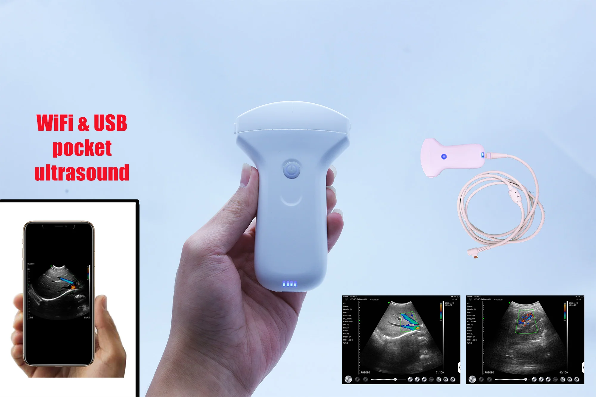 Multifunction 7.5/10mhz Portable Small Ultrasound Usb/wireless Linear Probe Price