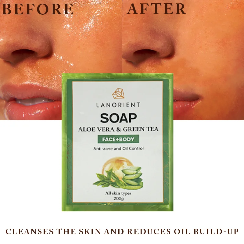 OEM LANORIENT Aloe Vera Soap Cleanser Anti-Acne Anti-Aging Skin Brightening Remove Dark Spots Oil Control Handmade Soap