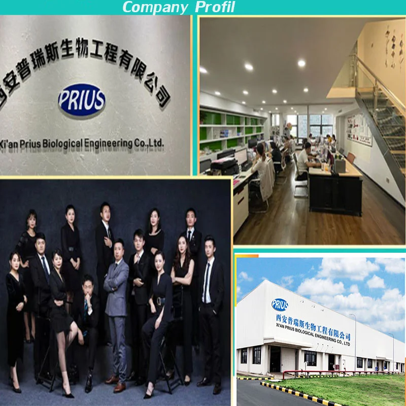 High quality  Superoxide Dismutase Powder 10,000 U / g SOD Superoxide Dismutase