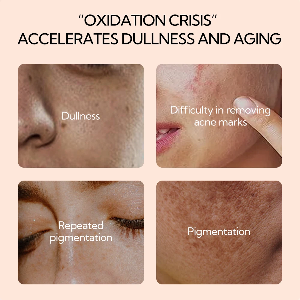 LANBENA New Vitamin C Face Serum Anti Aging Dark Spot Facial Serum Vit E Skin Care 30ML