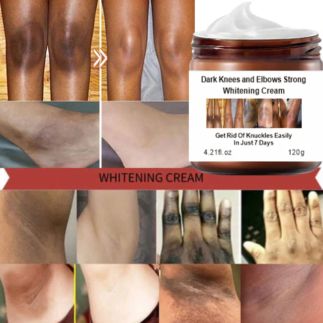 wholesale niacinamide dark knees knuckles elbows armpit whitening cream,woman private parts snow bleaching cream for dark skin