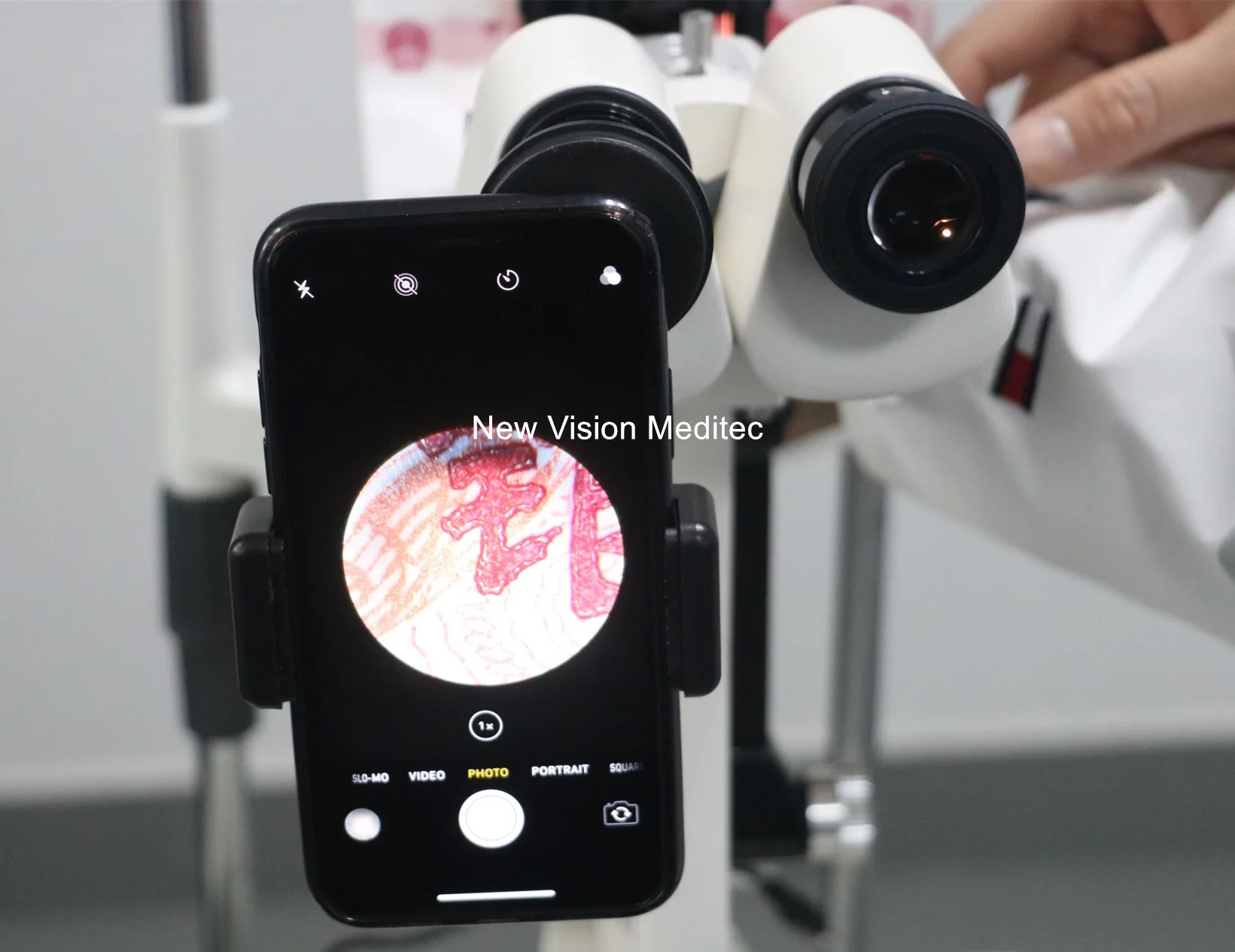 YZ5J Slit Lamp Microscope available with digital Upgrade Digital Slit Lamp