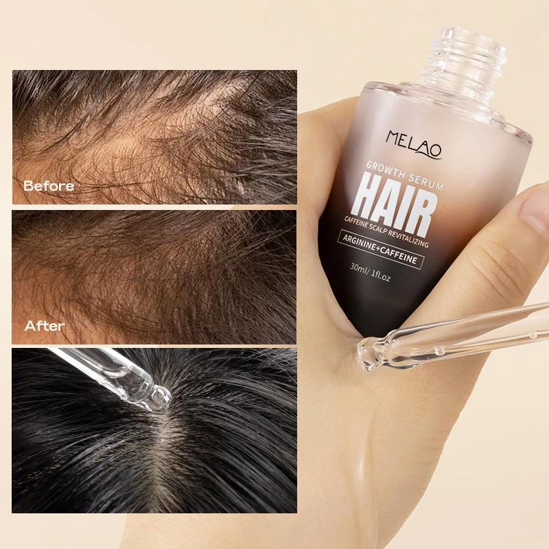 Custom Logohair Loss Treatment Scalp Serum Regrowth Anti Hair Fall Ginger Oil For Hair Growth Men
