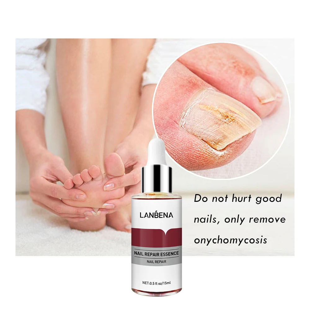 LANBENA Private Label Nail Fungal Treatment Serum Nail Care Repairing Nourishing Essence