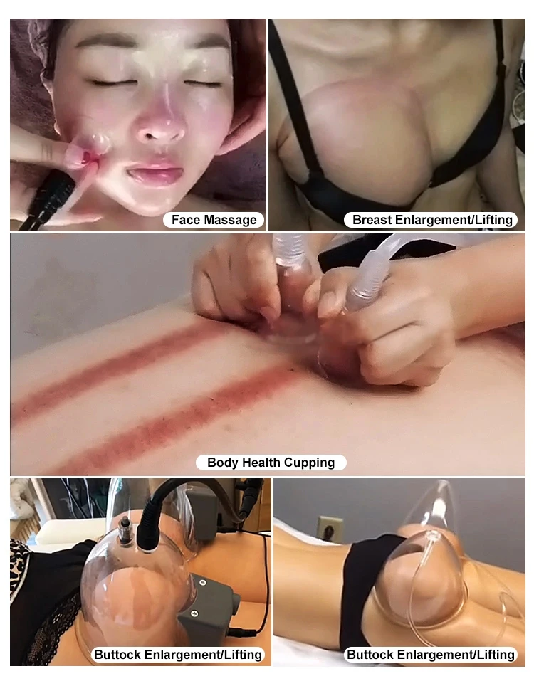 Factory Infrared 5D Body Cavitation New Big Lift Up Non Invasive Colombian Vac Therapy Circle Cup Columbia Vaccuum Butt Machines