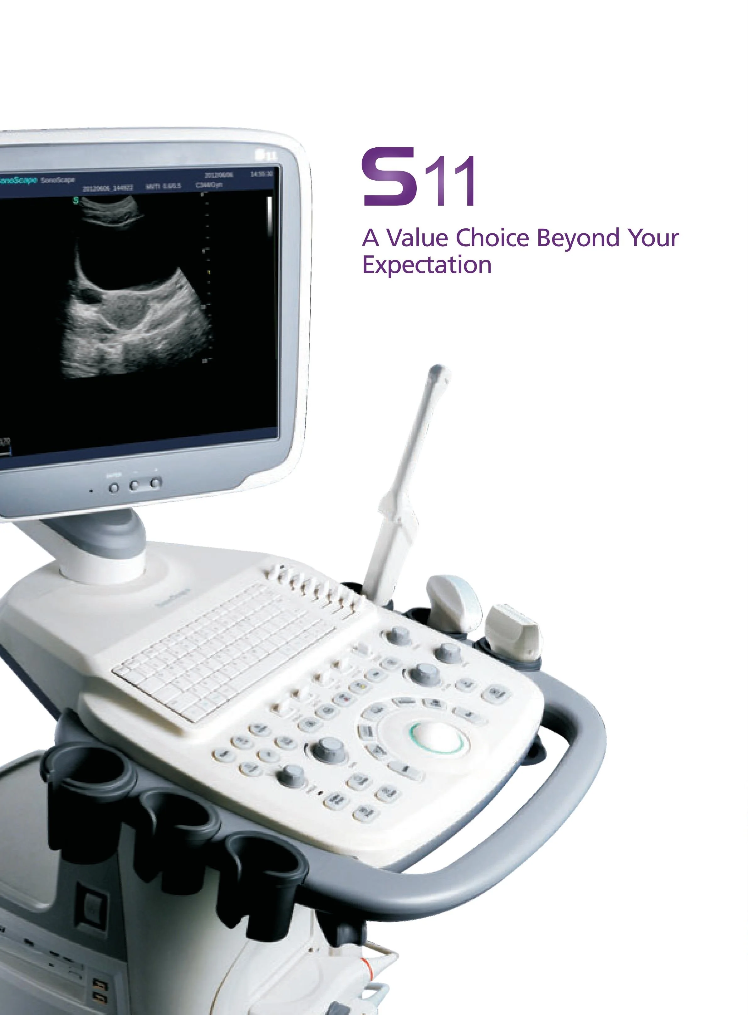 Sonoscape S11 Trolley Color Doppler UltrasoundUSG Gynecology Urology MSK 15 inch Display