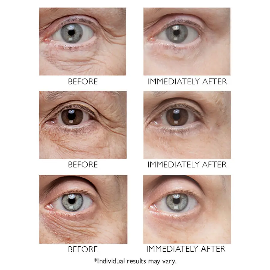 Private Label Custom Anti-Aging Eye Lift Cream Removal Dark Circles Bags Puffiness Instant Eye Tightening Cream
