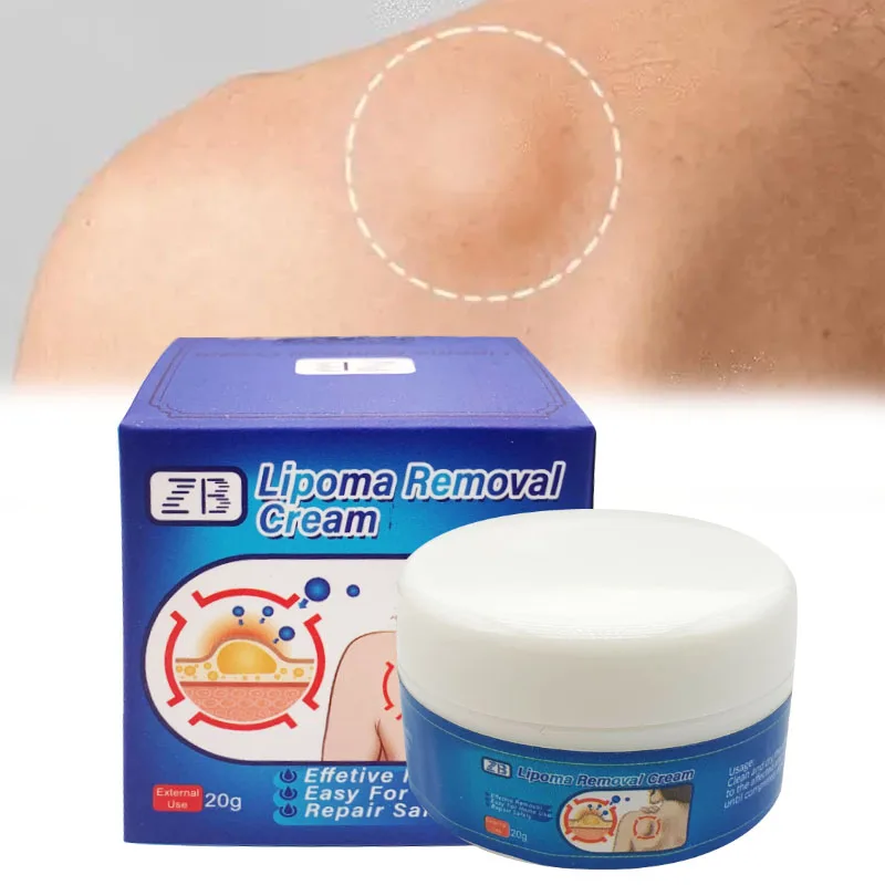 Лечение Lipoma, травяной пластырь, мазь для снятия боли, многоуровневый антиотек, пилинг, средство для снятия жира, крем, забота о здоровье, 20 г/коробка