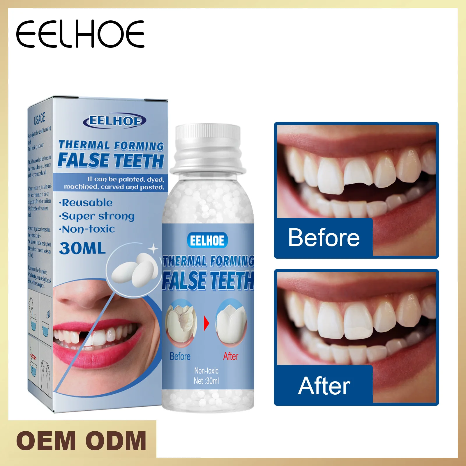 Thermal Fitting Beads Teeth Veneers Moldable Temporary Tooth Repair Kit for Fix the Missing Tooth Teaching