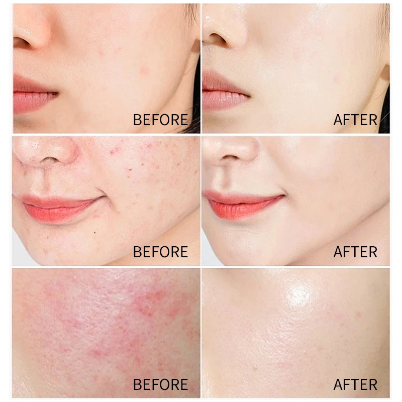 Private Label OEM Natural Organic face Skin bleaching Tightening anti aging bleach Moisturizer Whitening rice Skincare set