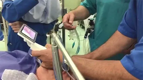 Portable Medical Visual Laryngopharyngeal Mirror 3.5 Inch OLED Screen Reusable Video Laryngoscope for ENT