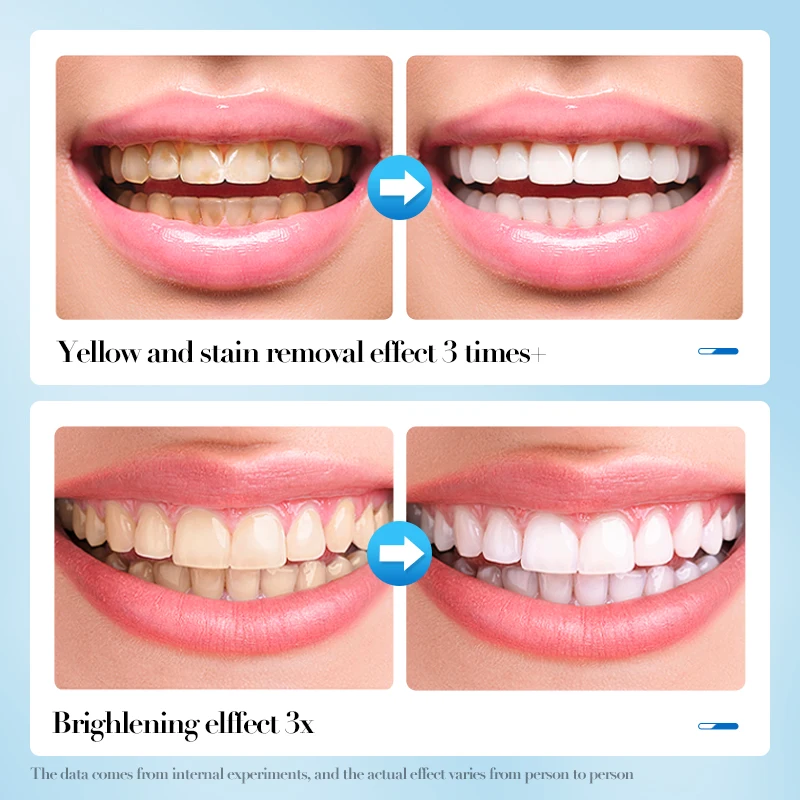 SADOER Private Label 60ml Foam Toothpaste Mint Flavor Tooth Mousse Teeth Whitening cleaning Foam For Daily Dental Care
