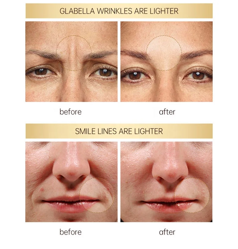 Hot Sales  Private Label Natural Organic Facial Skin Care Anti Aging Anti Wrinkle Retinol Face Serum
