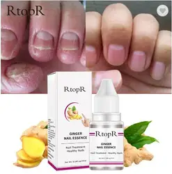 RtopR ginger nail repair serum oil nail care remove onychomycosis toe nourishing foot nail care 10ml