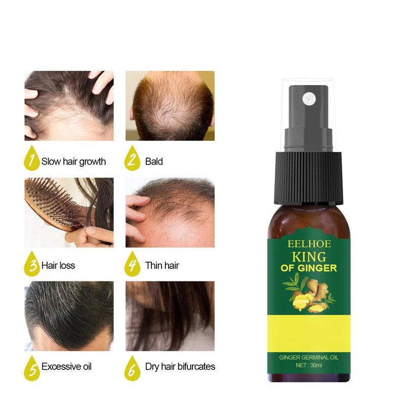 Anti Loss Itching Scalp Elixirs Herbal Instant Hair Growth Products Spray Oil For Black Women Private Label
