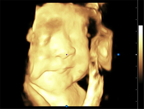 DW-P5pro  Portable Medical Machine Ultrasound Scanner High-end 4D Color Doppler Ultrasound Machine