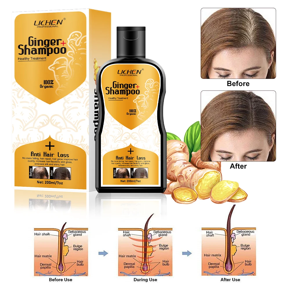 100% herbal plant ginseng anti-dandruff shampoo hair falling ginger shampoo hair loss