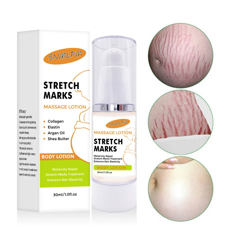 High quality pregnancy scars treatment acne removal stretch mark repair cream