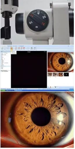 Professional SLM-3ER with Highest Quality Best Price Digital Slit Lamp Ophthalmic equipment ophthmology instrument