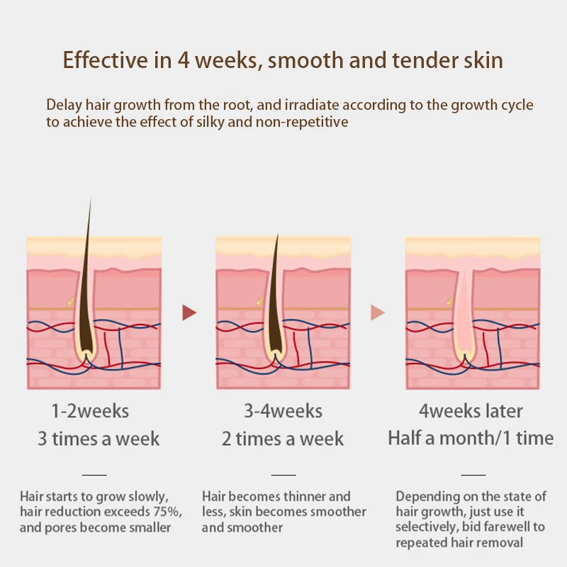 
Factory Direct IPL Laster Hair Removal Device Permanent Laser Epilator 