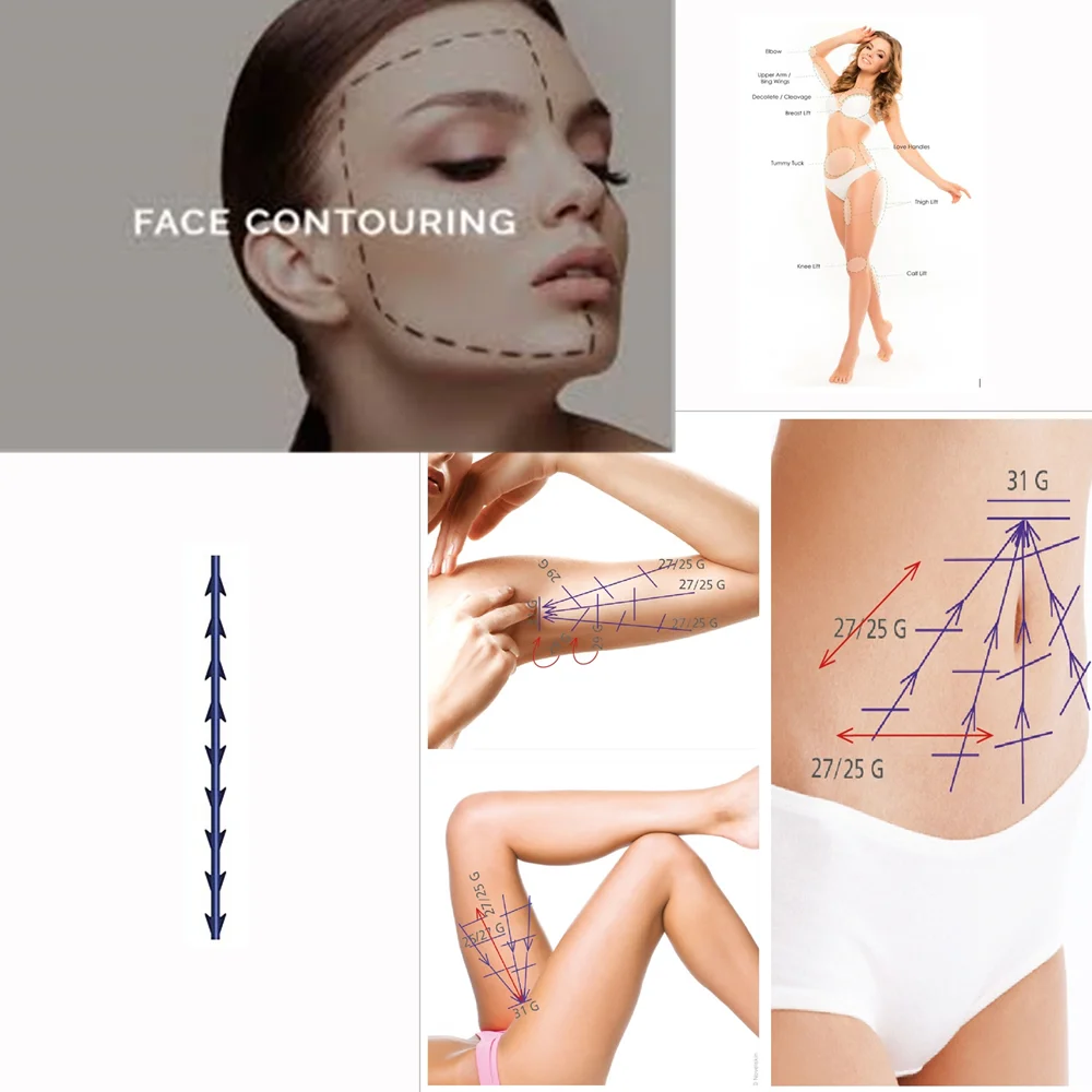 Face V Lift Eyebrow Lifting Cog Thread Medical Improves Wrinkle Eye Wrinkle Filler Skin Firming PDO Fishbone Thread