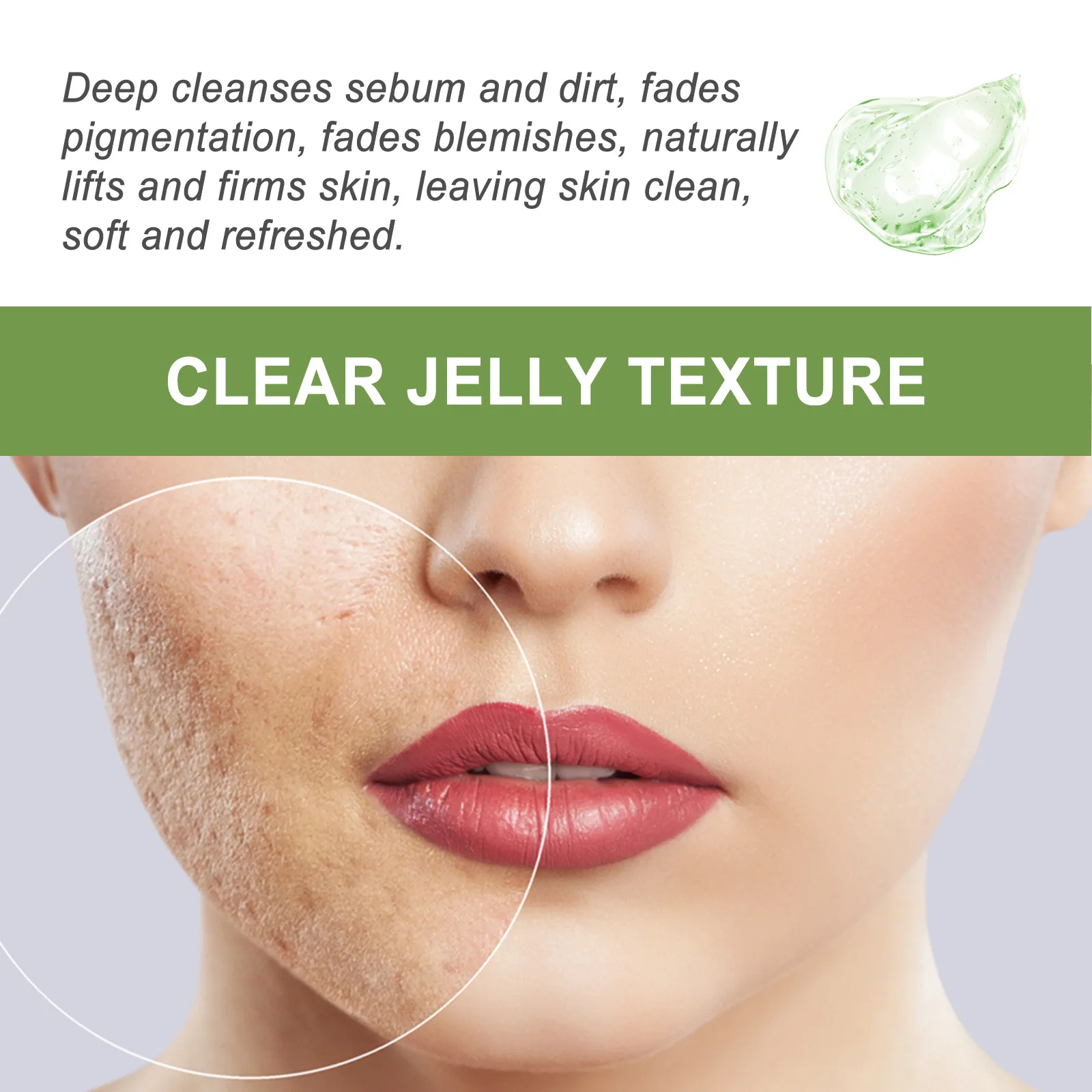 private label oem custom logo  Acid Facial Exfoliating Gel Deep clear pores blackheads Acne Whitening Skin Gel