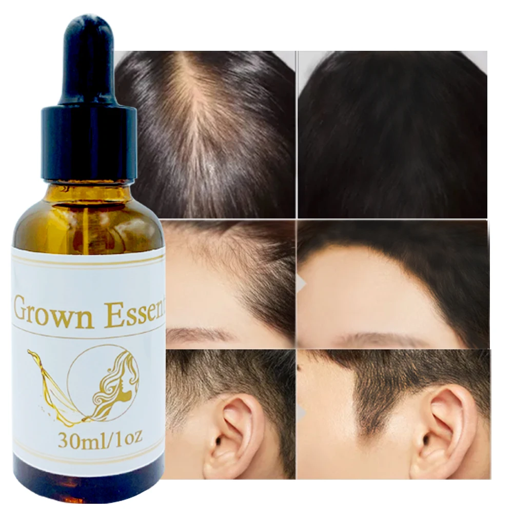 Private Label OEM Fast Organic Herbal Custom Men Care Anti Hair Loss Serum Fall Ginger Hair Growth Oil for Hair Regrowth