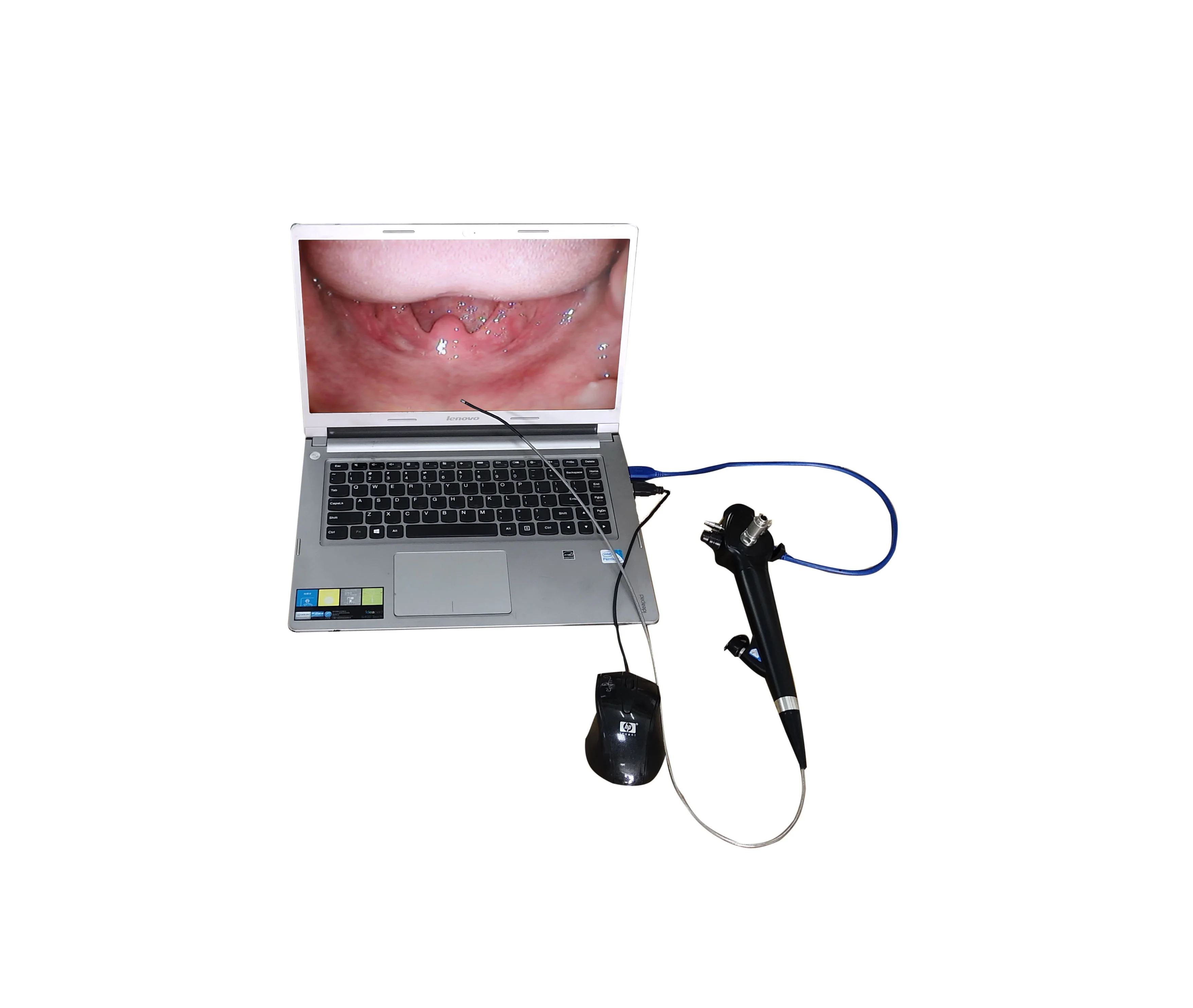 
Medical Portable CMOS Optic Flexible Endoscope Cystoscope 