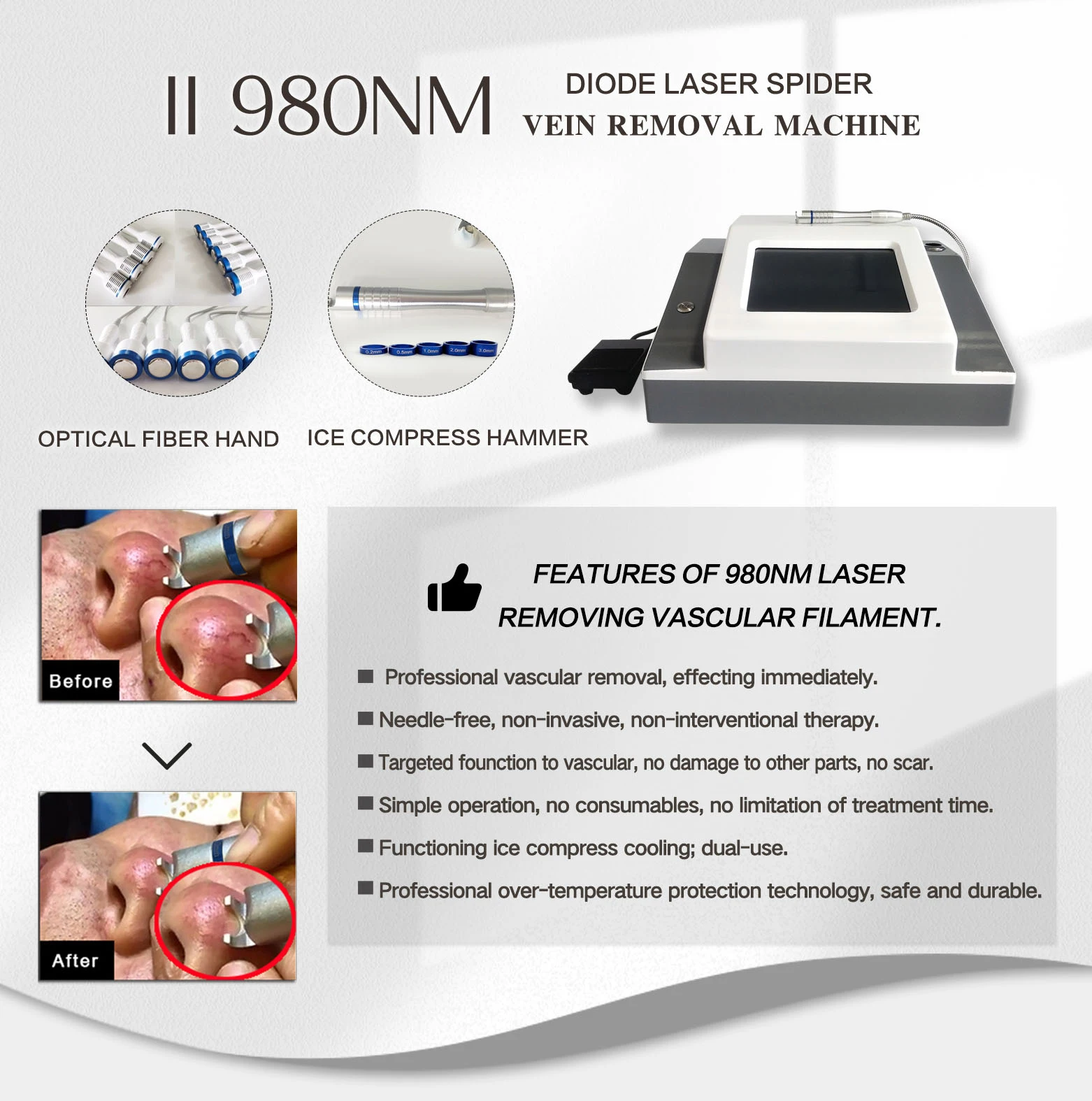 980nm-laser-Vascular11.jpg