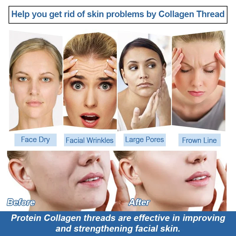 collagen thread (5).jpg