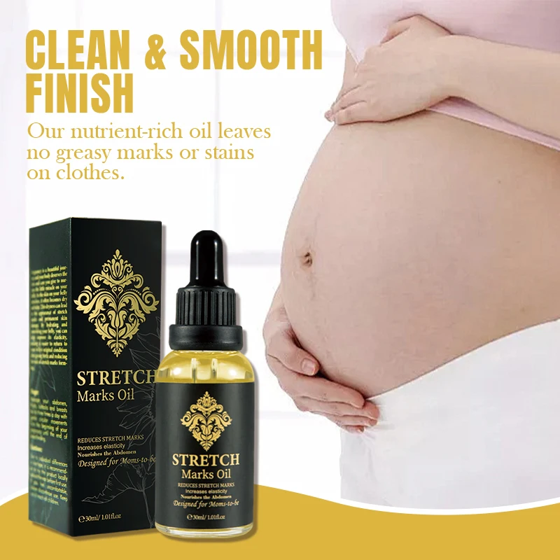 Wholesale Best Natural Stretch Marks Oil Skincare Moisturize Removal Stretch Mark Body Oil For Pregnant Scars Stretch Marks