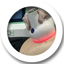 Professional  portable trusculpt id body sculpting fat reduction  Molopolar  RF  trufat slimming double chin removal machine BCM