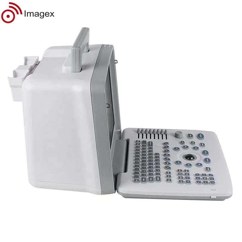 Factory Price Medical Ultrasound Scanner for Obstetric and Gynecological Use