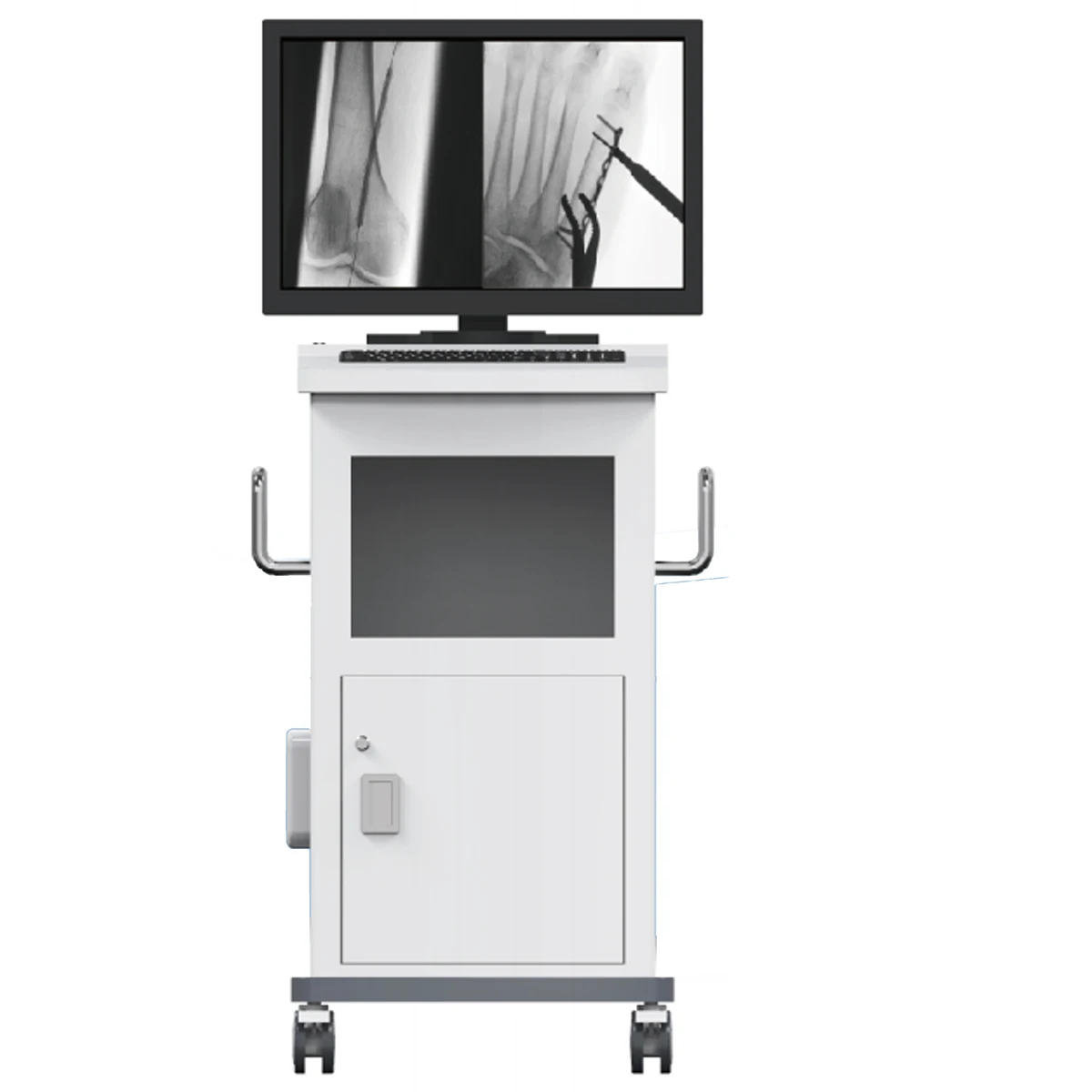 High Frequency 5.6kw Mobile Digital FPD C-arm fluoroscopy surgical x ray c arm machine MSLCX50