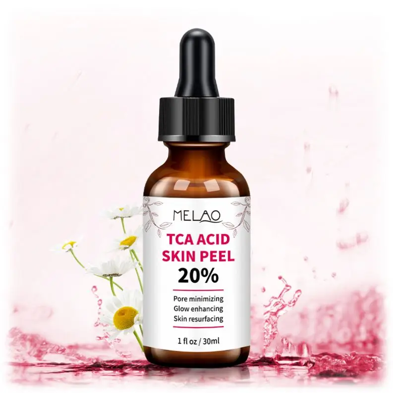 Shyway Natural Skin Lightening 20% Tca Chemical Acid Face Skin Peel tca acid skin peel