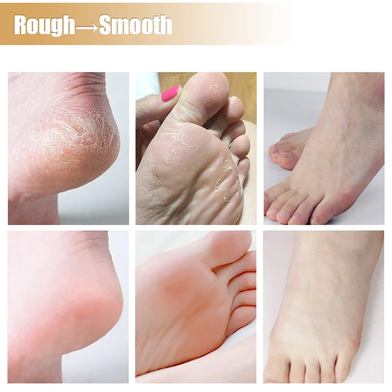 Anti Crack Foot Cream Heel Cracked Repair Horse Oil Cream Smooth Removal Dead Skin Callus Anti-Drying Hand Feet Skin Care 30g