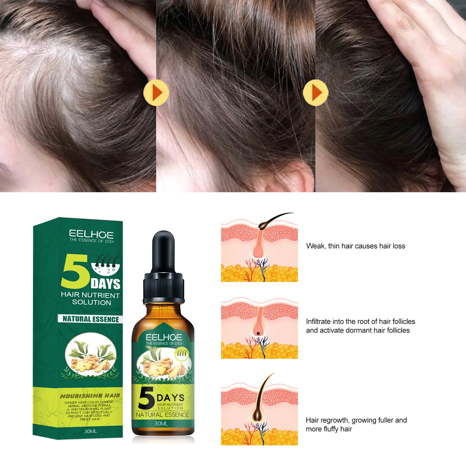 Costom Hair Growth Products Ginger Fast Growing Beauty Care Prevent Hair Loss Oil Scalp Treatment Hair Essential Oil