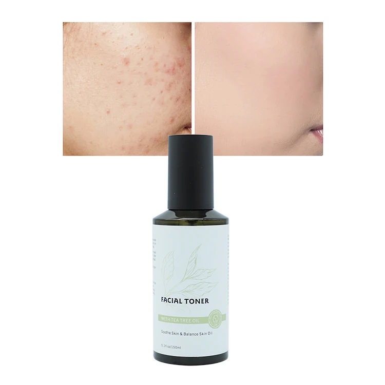 Wholesale Skin Care Anti Acne Tea Tree toner Private Label  Oil Control  Moisturizing Tea Tree Facial Toner Spray