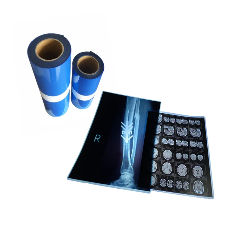 Качественная прозрачная пленка, 175mic PET Blue Inkjet, рулоны медицинской пленки для Fujifilm