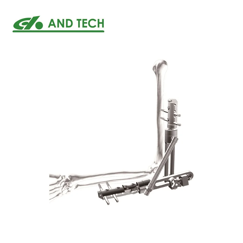 Ортопедический фиксатор для наружной фиксации локтя тип ортофиксации хирургический инструмент для перелома Кости Фрагмент верхней конечности