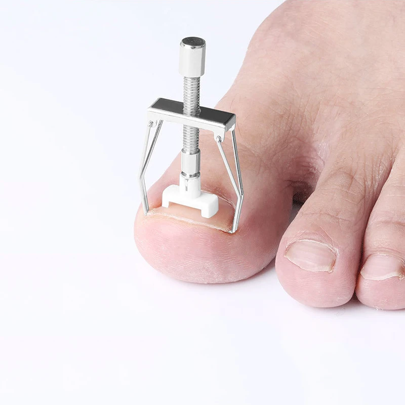 New Podologia Ingrown Toenail Corrector Manicure Pedicure Nail Correction Tool Set Stainless Steel Podiatry Tools