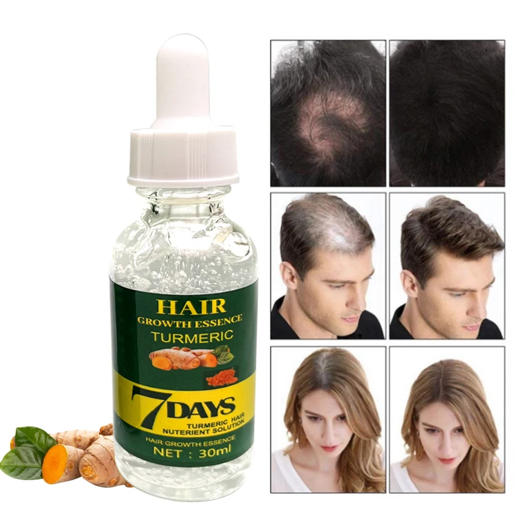 Wholesale Private Label Ginger Faster Hair Growth Oil Hair Loss Treatment