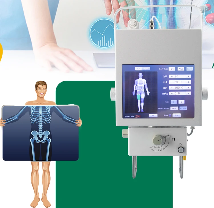 Professional Touch Screen Mobile X ray Machine Portable Digital X Ray Machine in Stock Price Cheap