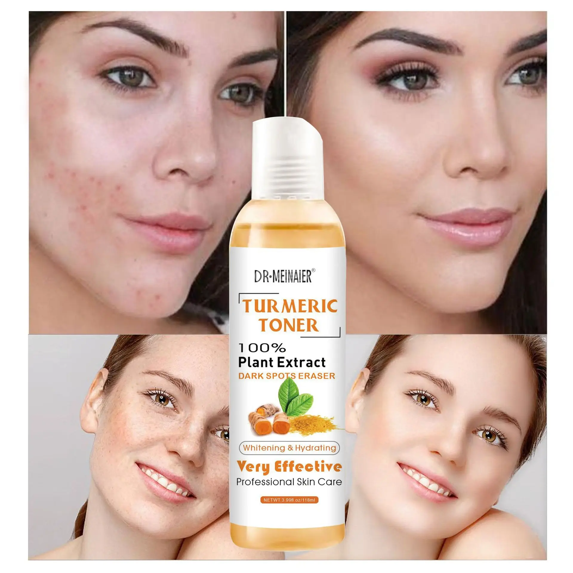 Private Label Facial Lightening Turmeric Dark Spots Toner Spots Eraser For Skin Whitening