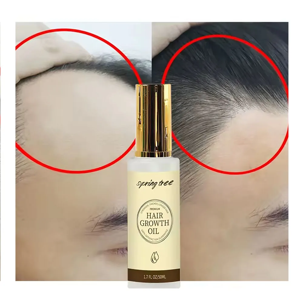 Fast Speed Organic Rosemary Oil Hair Growth For women and men Natural Volumizing Thickening Hair Growth Oil