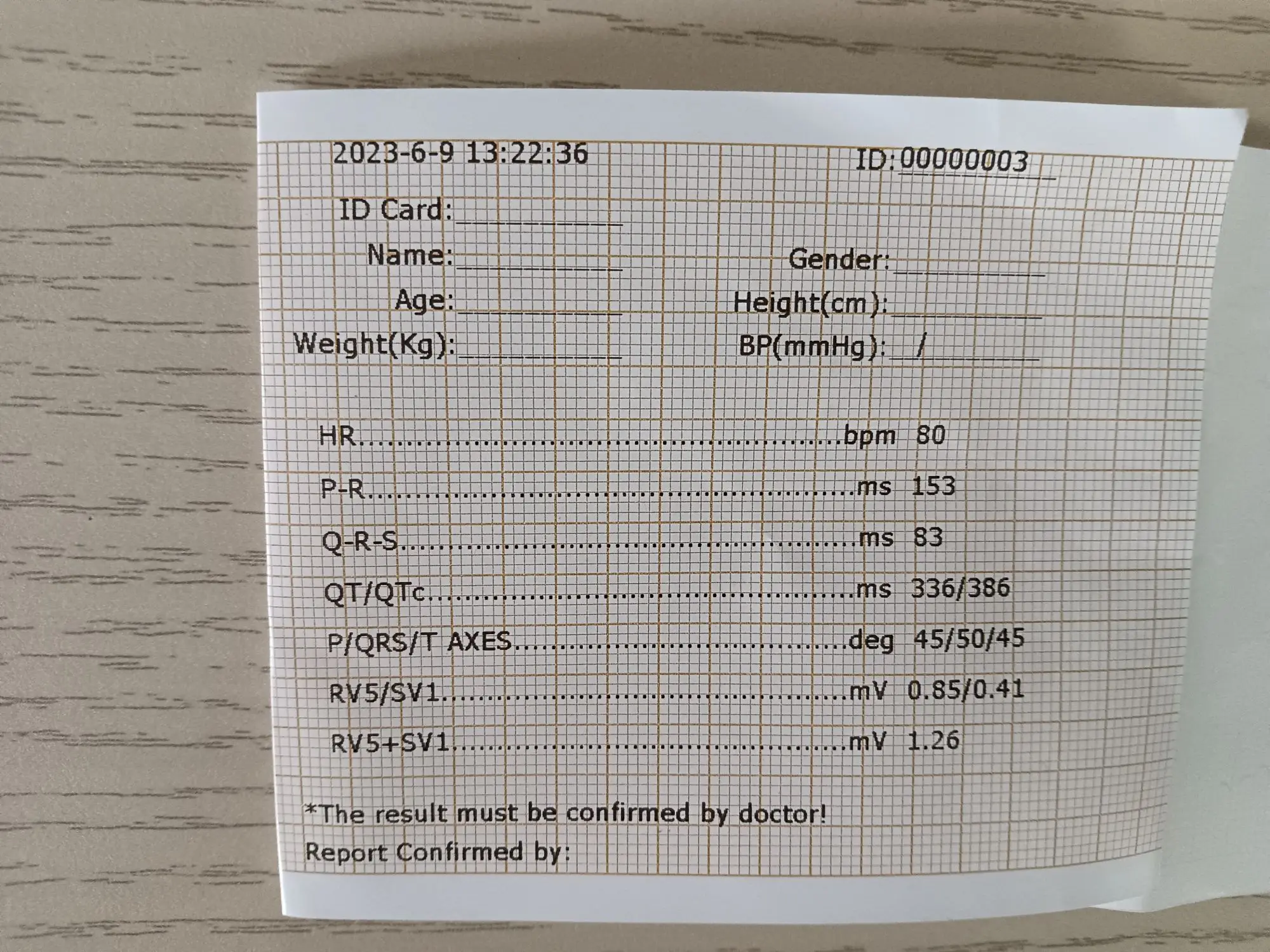 Vet ECG Machine For Animal