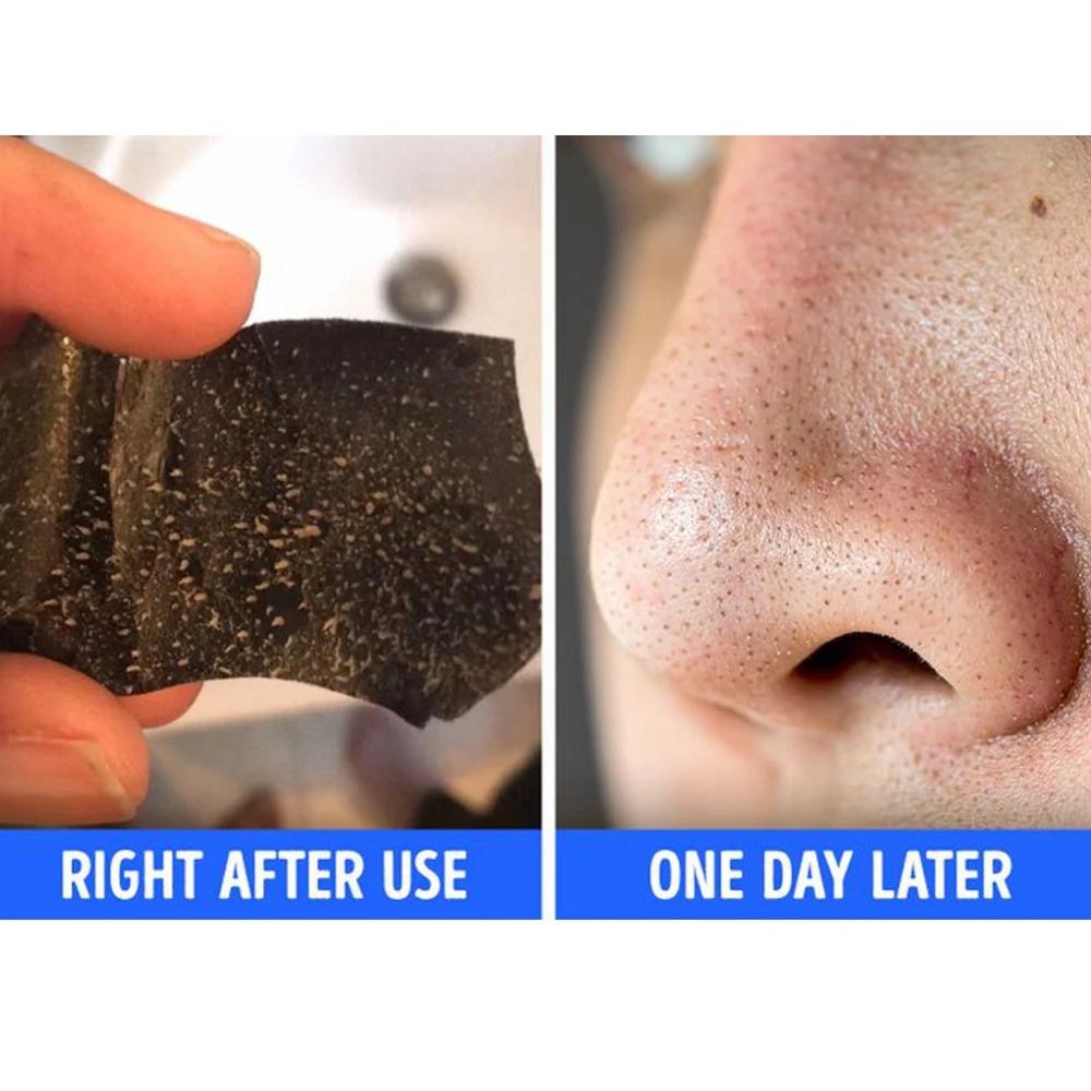 Custom Logo Labels New Design Large Area Pore Nose Deep Cleansing Nose Strip For Blackheads