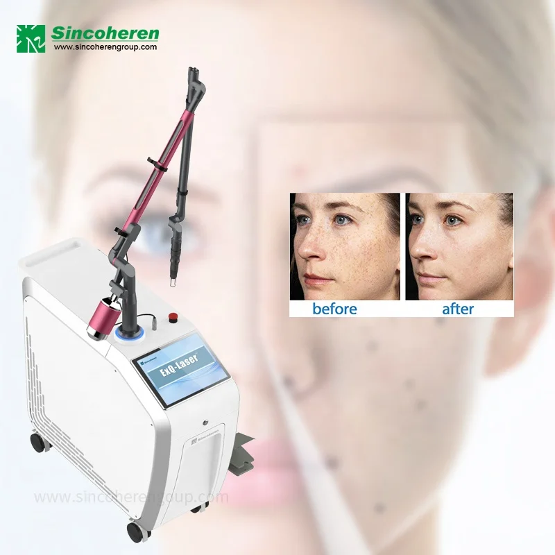 2023 q switched nd yag laser tattoo removal machine q switch laser with South Korea imported light guide arm