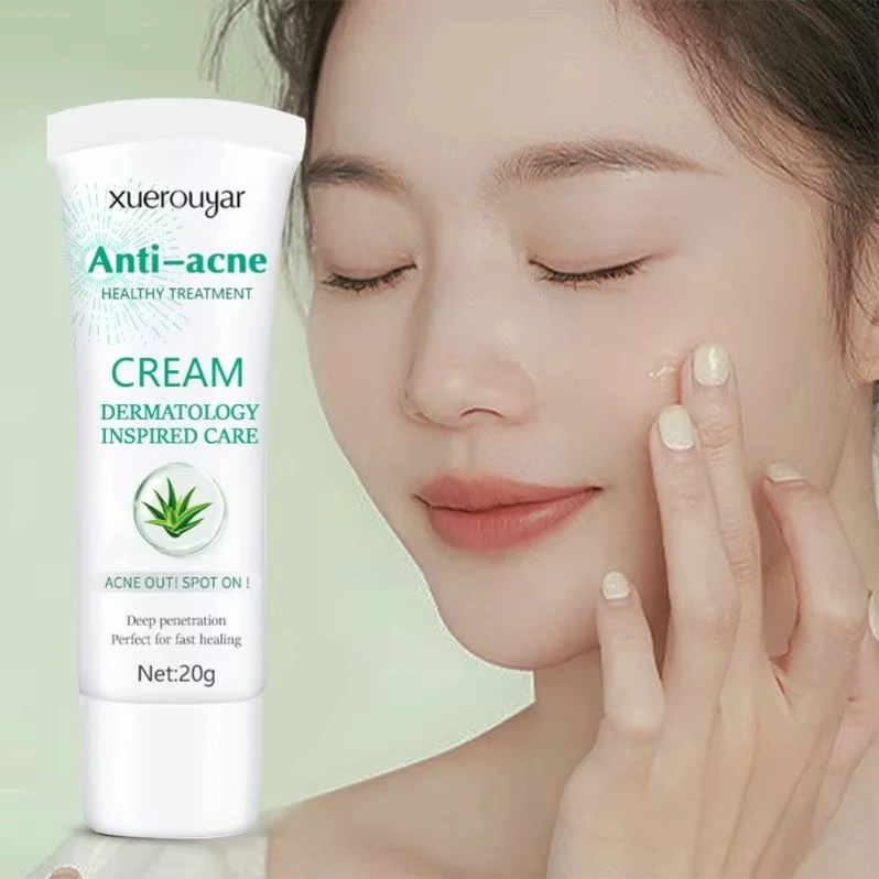 Skin Care Repair Pimples Acne Smooth Skin Shrink Pores Skin Moisturizer Gentle Anti Acne Whitening Aloe Vera Acne Face Cream