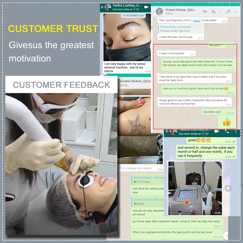 Новый дизайн Настольный пикосекундный q переключатель Nd:yag Лазерный углеродный пилинг пикосекундная машина удаление татуировки